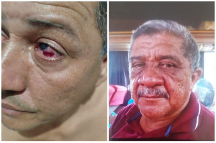 Vereador é agredido por cabo eleitoral do prefeito de Altos/ Foto: reproduções