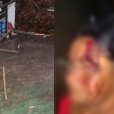 Homem é preso após agredir esposa e sogra com pedaço de madeira no Piauí