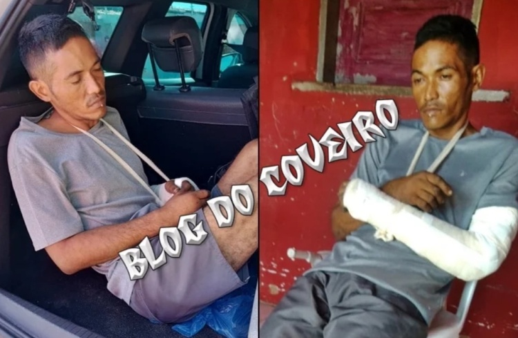 Edson foi agredido por populares e preso ao receber alta - Foto: Blog do Coveiro