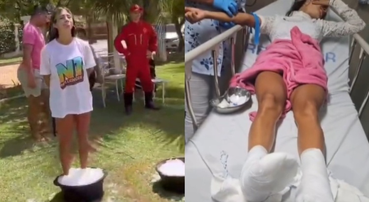 MC Thammy sofreu queimadura nos pés durante prova de reality show de Anderson Neiff — Foto: Reprodução/Instagram
